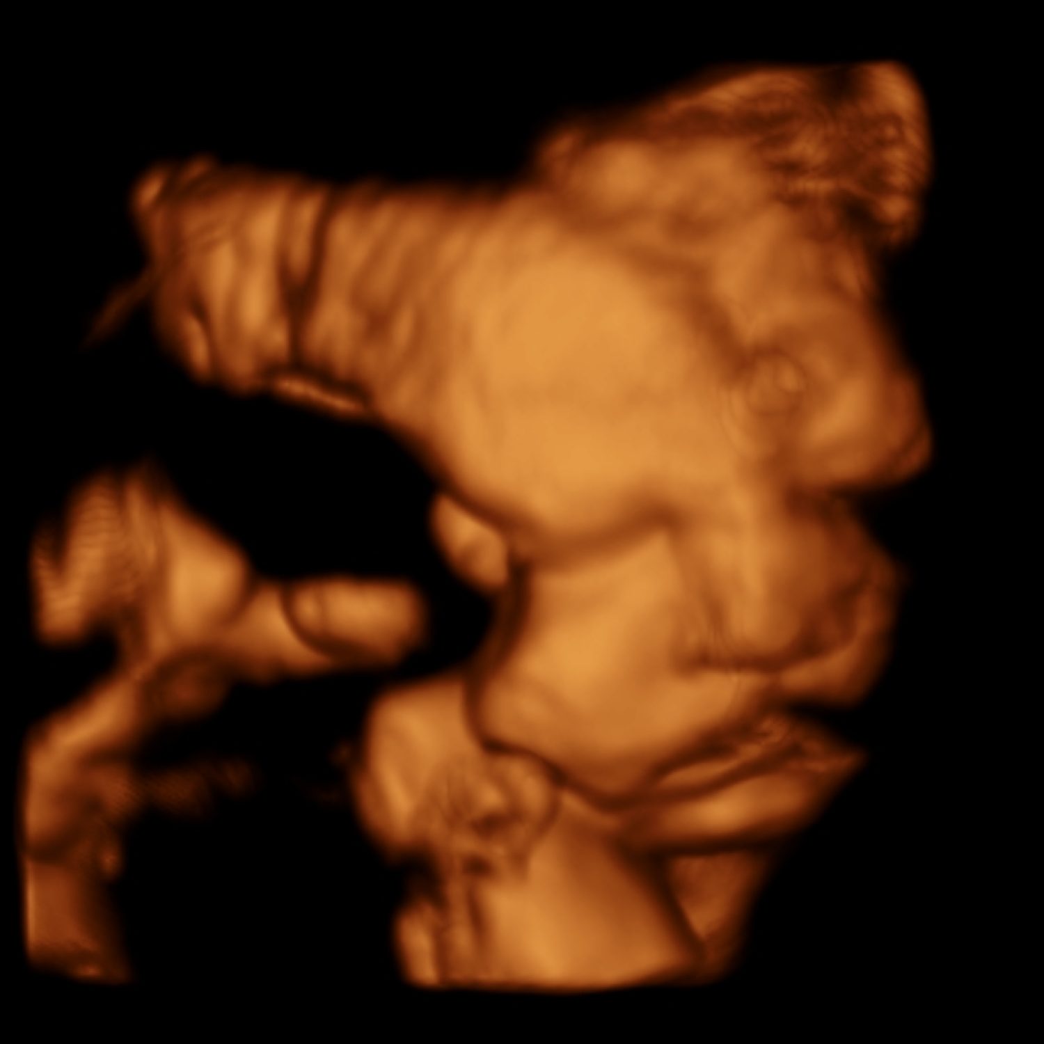 22380340-7_CATALINAVARGASVIDELA_202310230002_3D